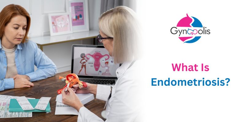 What Is Endometriosis