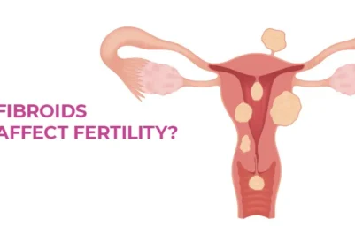 How to Protect Your Fertility from Fibroids