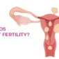 How to Protect Your Fertility from Fibroids 85x85